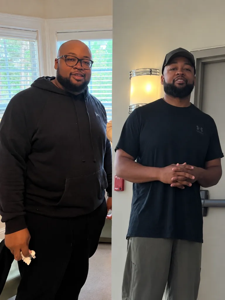 SlimRX patient before and after weight loss photos: 100+ Pounds Lost