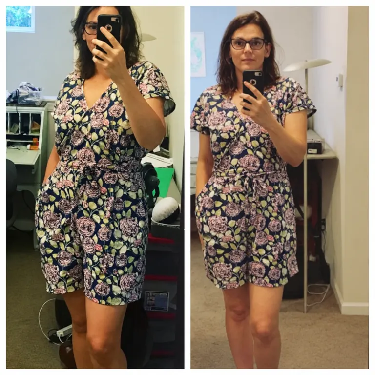 SlimRX patient before and after weight loss photos: Lost 20 Pounds