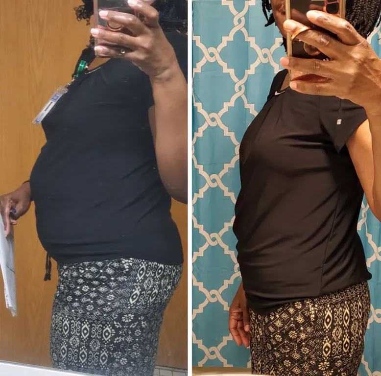 SlimRX patient before and after weight loss photos: Lost 25 Pounds