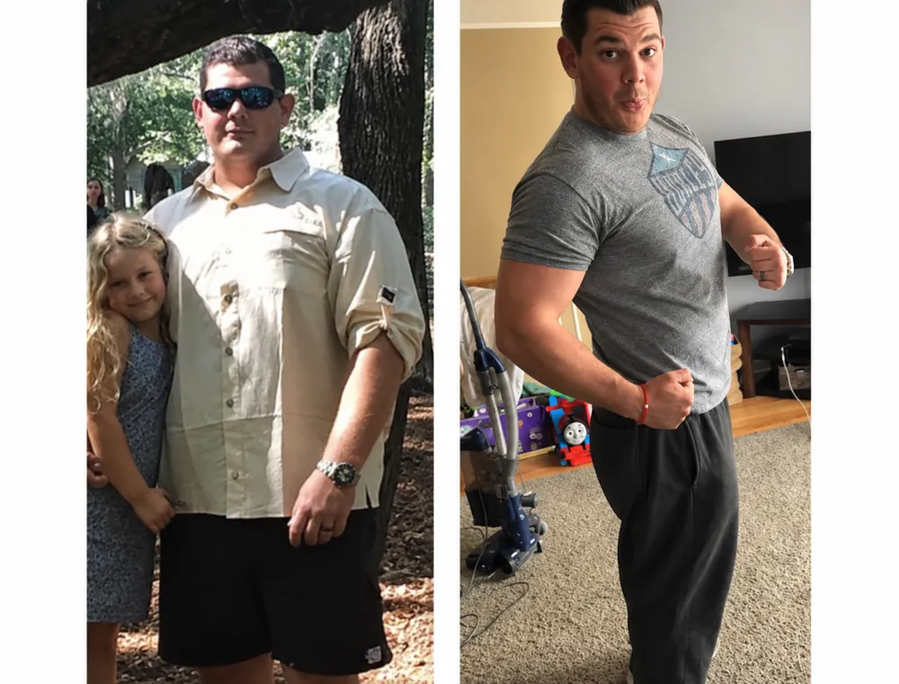 SlimRX patient before and after weight loss photos: Lost 72 Pounds