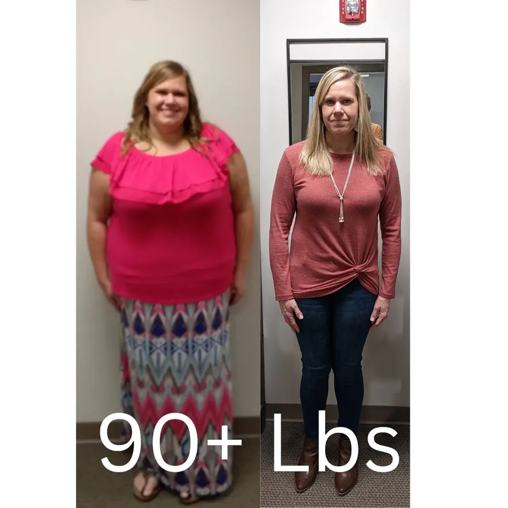 SlimRX patient before and after: 90+ Pounds