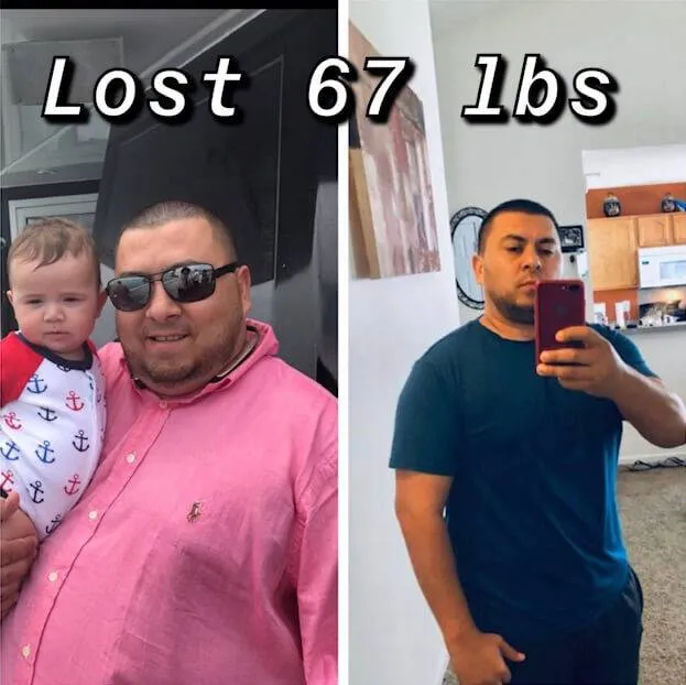 SlimRX patient before and after: Lost 67 Pounds