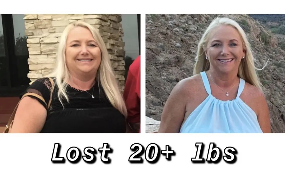 SlimRX patient before and after: Lost 20+ Pounds
