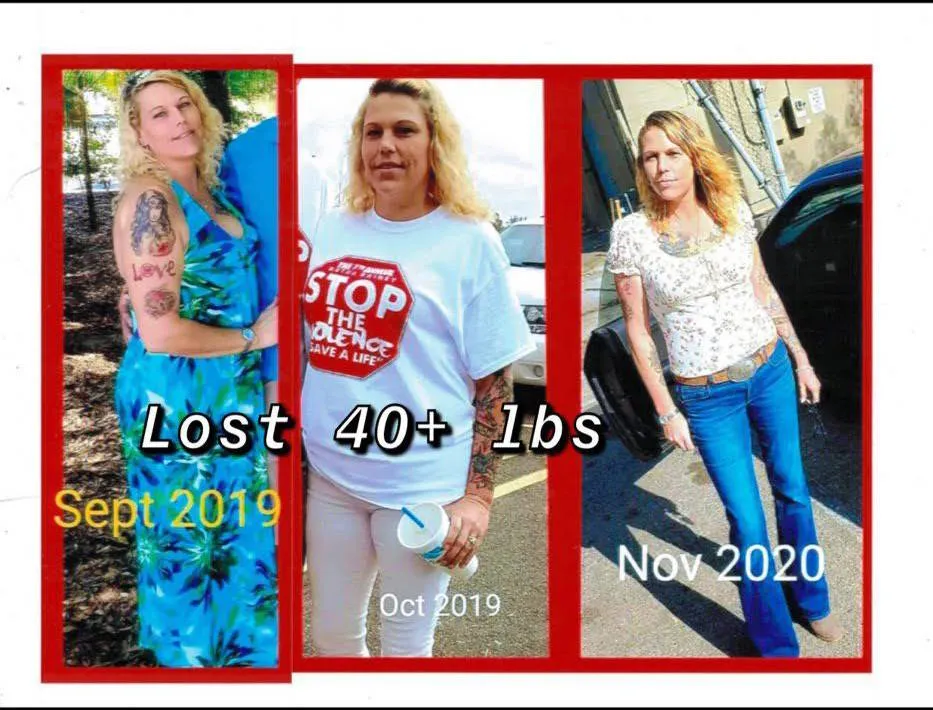 SlimRX patient before and after: Lost 40+ Pounds